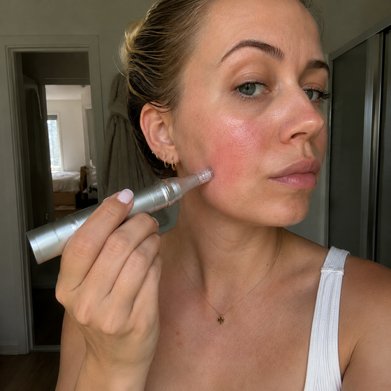 Elektrisk Microneedling Dermapen