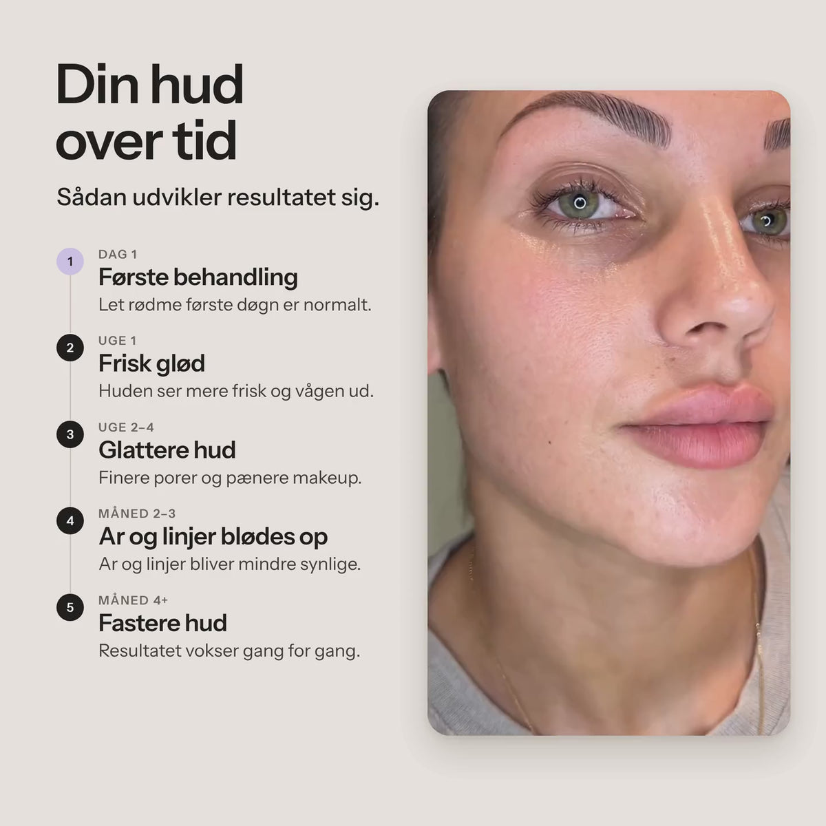 Din hud over tid med Feevra Microneedling Pen – video